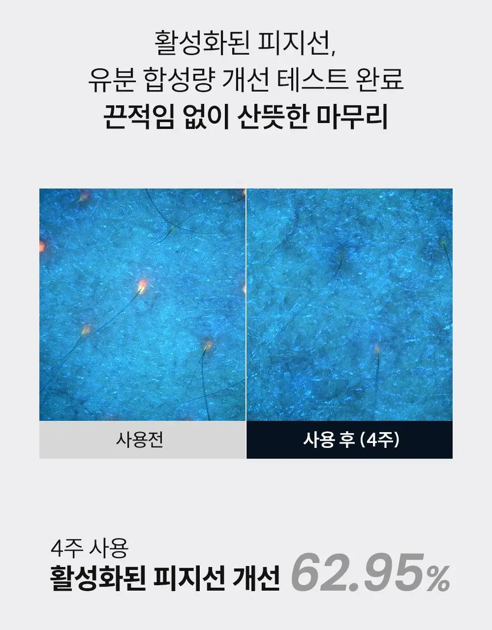 [등드름/체취케어] 낫포유 지성피부전용 등드름/가드름 클리어 바디미스트 포맨 200ml 상세페이지 35